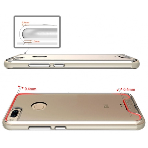 Xiaomi Mi A1 Kılıf Clear Guard Serisi Gard Kapak - Şeffaf