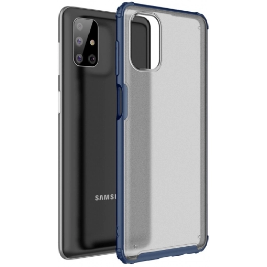 Samsung Galaxy M51 Kılıf Volks Serisi Kenarları Silikon Arkası Şeffaf Sert Kapak - Lacivert