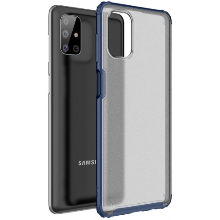 Samsung Galaxy M51 Kılıf Volks Serisi Kenarları Silikon Arkası Şeffaf Sert Kapak - Lacivert