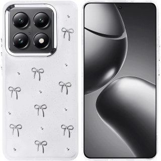 Xiaomi Mi 14T Pro Kılıf Airbag Tasarımlı Simli Şeffaf Zore Kutup Kapak - Fiyonk