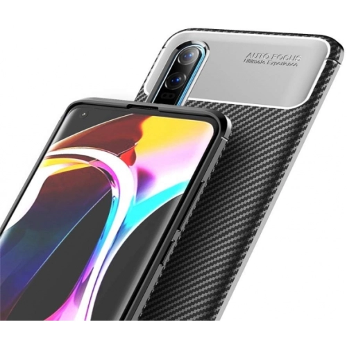 Xiaomi Mi 10 Pro Kılıf Silikon Parmak İzi Bırakmayan Karbon Soft Negro Kapak - Lacivert