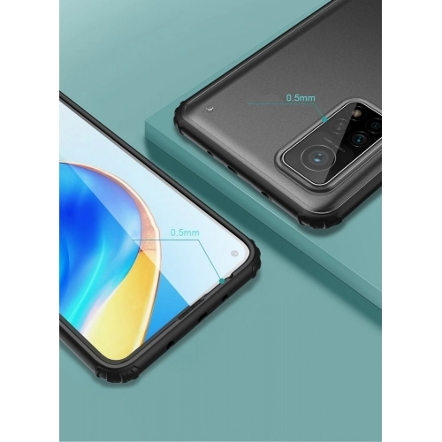 Xiaomi Mi 10T Pro Kılıf Volks Serisi Kenarları Silikon Arkası Şeffaf Sert Kapak - Lacivert