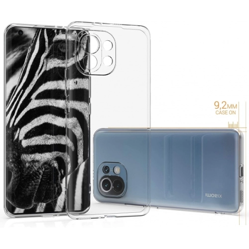 Xiaomi Mi 11 Kılıf Kamera Korumalı Esnek Silikon Kapak - Şeffaf