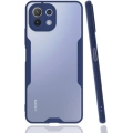 Xiaomi Mi 11 Lite Kılıf Renkli Silikon Kamera Lens Korumalı Şeffaf Parfe Kapak - Lacivert