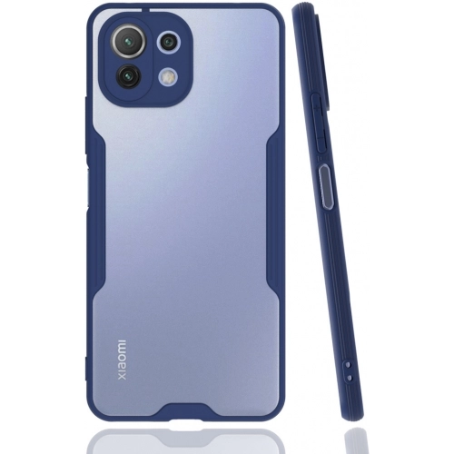Xiaomi Mi 11 Lite Kılıf Renkli Silikon Kamera Lens Korumalı Şeffaf Parfe Kapak - Lacivert