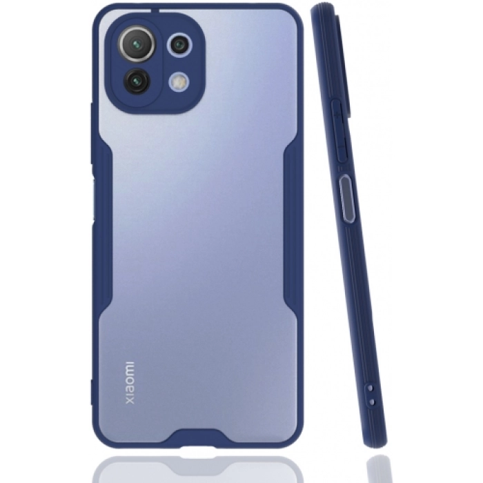 Xiaomi Mi 11 Lite Kılıf Renkli Silikon Kamera Lens Korumalı Şeffaf Parfe Kapak - Lacivert
