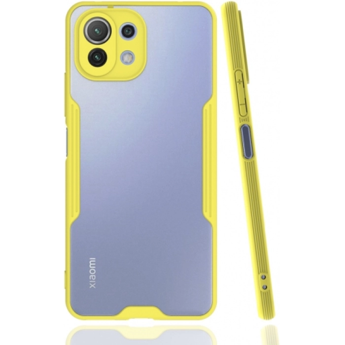 Xiaomi Mi 11 Lite Kılıf Renkli Silikon Kamera Lens Korumalı Şeffaf Parfe Kapak - Sarı
