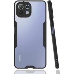Xiaomi Mi 11 Lite Kılıf Renkli Silikon Kamera Lens Korumalı Şeffaf Parfe Kapak - Siyah