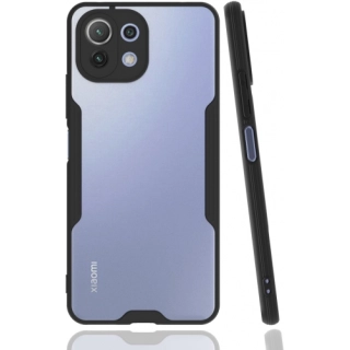Xiaomi Mi 11 Lite Kılıf Renkli Silikon Kamera Lens Korumalı Şeffaf Parfe Kapak - Siyah