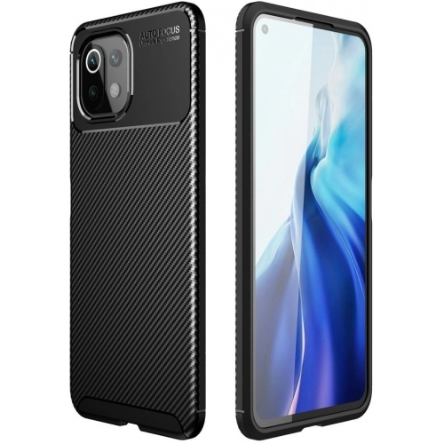 Xiaomi Mi 11 Lite Kılıf Silikon Parmak İzi Bırakmayan Karbon Soft Negro Kapak - Siyah