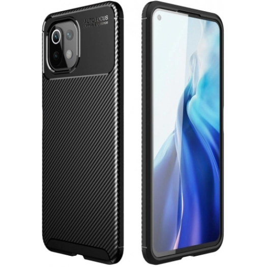 Xiaomi Mi 11 Lite Kılıf Silikon Parmak İzi Bırakmayan Karbon Soft Negro Kapak - Siyah