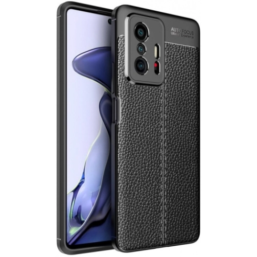 Xiaomi Mi 11T Kılıf Deri Görünümlü Lüks Parmak İzi Bırakmaz Niss Silikon Kapak - Siyah
