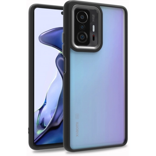 Xiaomi Mi 11T Kılıf Electro Silikon Renkli Flora Kapak - Siyah