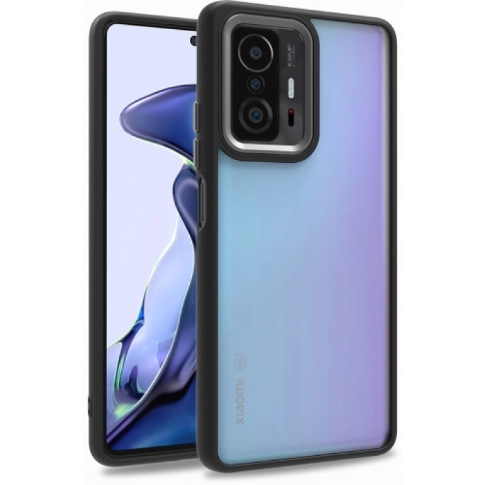 Xiaomi Mi 11T Kılıf Electro Silikon Renkli Flora Kapak - Siyah