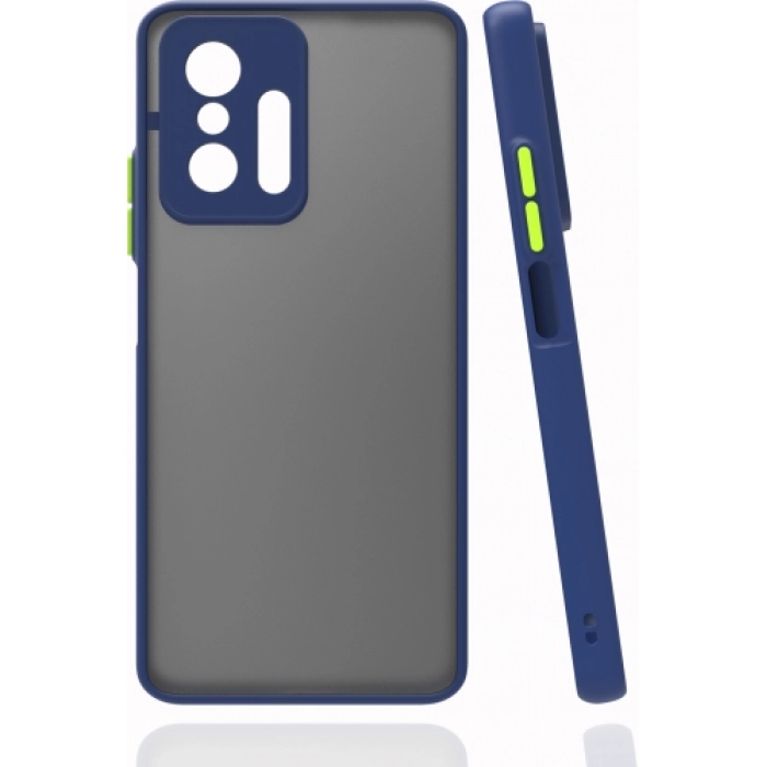 Xiaomi Mi 11T Kılıf Kamera Korumalı Arkası Şeffaf Mat Silikon Kapak - Lacivert