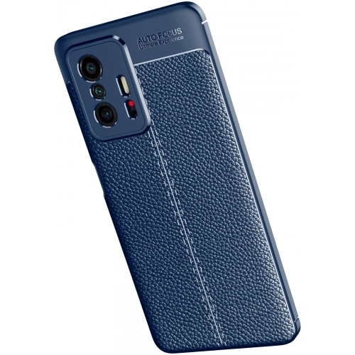 Xiaomi Mi 11T Pro Kılıf Deri Görünümlü Lüks Parmak İzi Bırakmaz Niss Silikon Kapak - Siyah