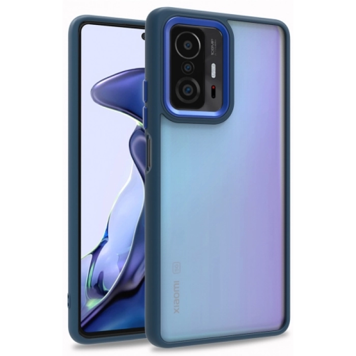 Xiaomi Mi 11T Pro Kılıf Electro Silikon Renkli Flora Kapak - Mavi