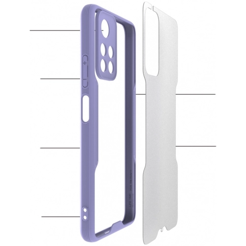 Xiaomi Redmi Note 11 5G Kılıf Renkli Silikon Kamera Lens Korumalı Şeffaf Parfe Kapak - Siyah